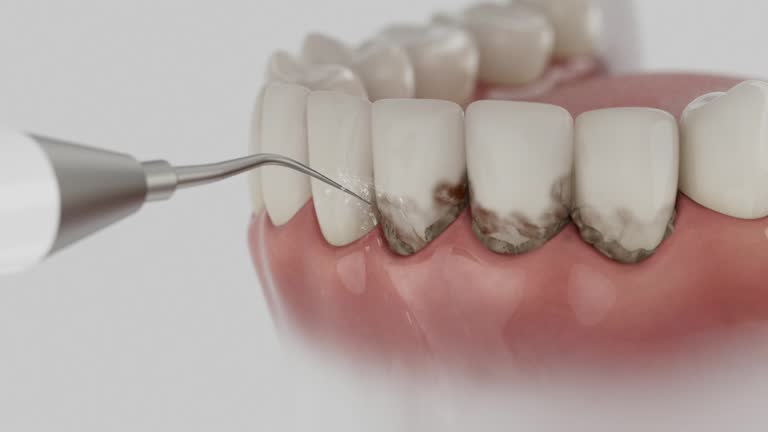 Trusted Teeth Cleaning And Checkup service in Briar, TX - Dentist Open Now